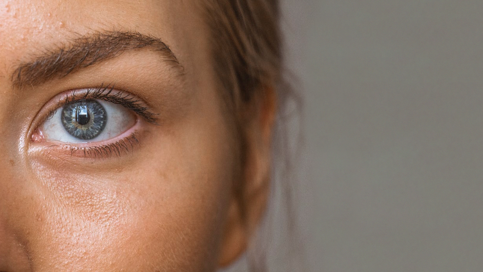 Sinis Geelachtig adelaar Acne behandeling: welke BIODERMA routine? | BIODERMA