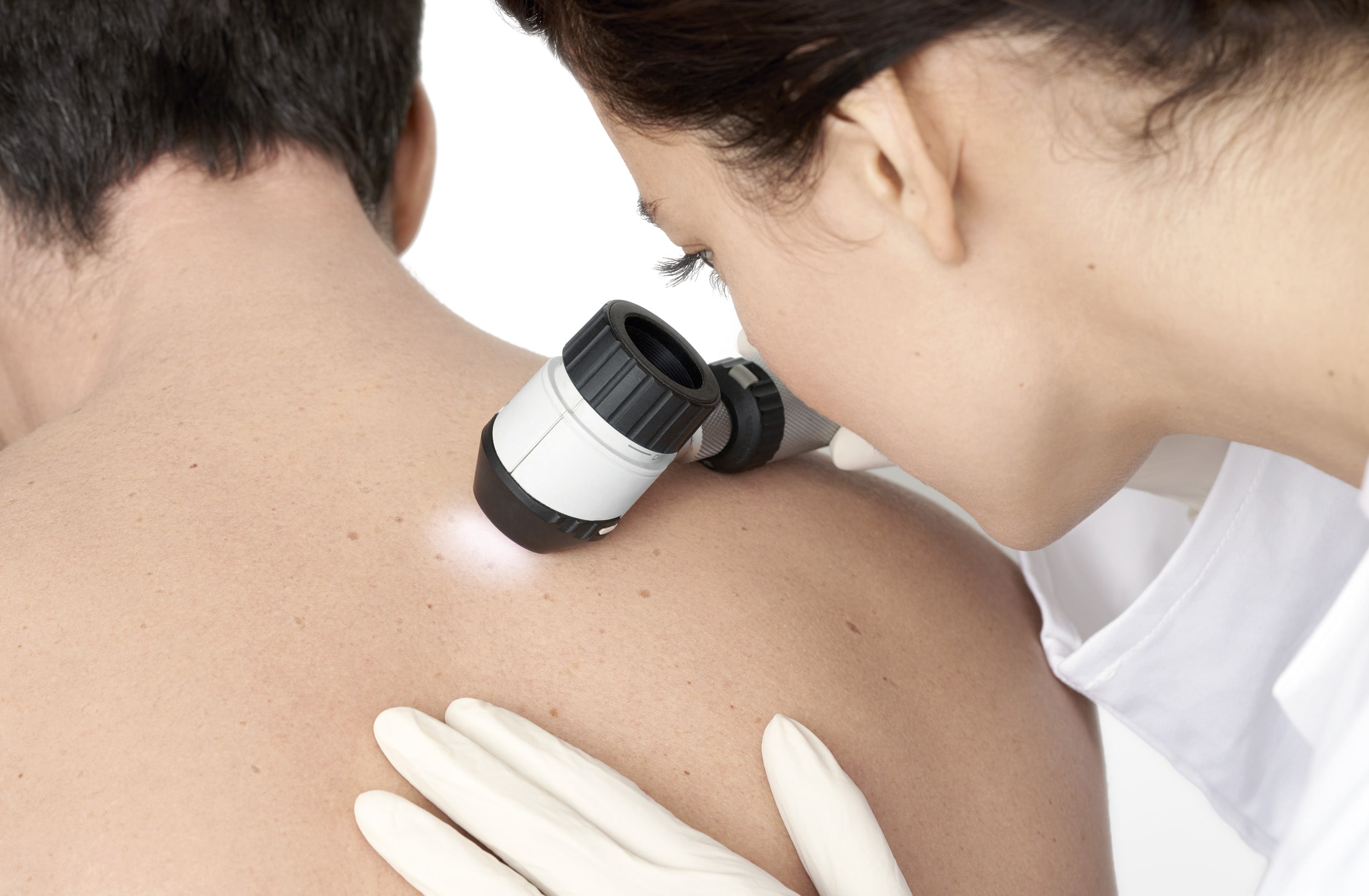 Moet een psoriasis behandeling ook gepaard gaan met stress management? |  BIODERMA