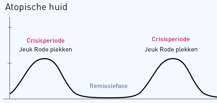 Atopische huid