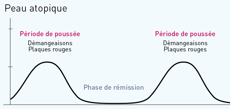 peau atopique fonctionnement