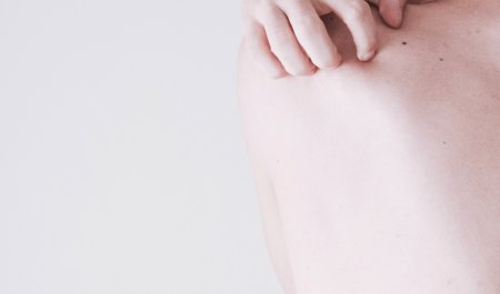 Woman back skin Woman back skin