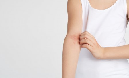 Bioderma - atopic skin itching Bioderma - atopic skin itching