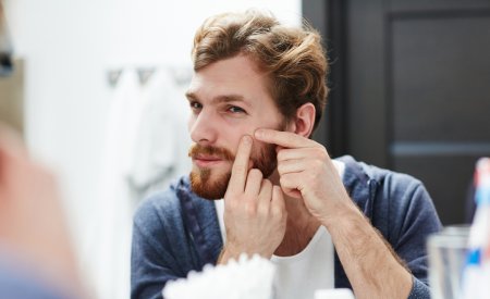 Bioderma - Man with acne Bioderma - Man with acne