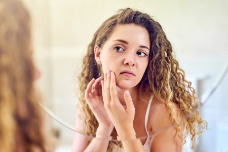 Conseils pour mieux vivre et supporter l'acné sévère bioderma